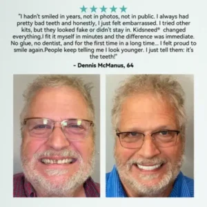 💎𝐊𝐢𝐝𝐬𝐧𝐞𝐞𝐝® 𝐇𝐲𝐝𝐫𝐨𝐒𝐡𝐚𝐩𝐞 𝐓𝐡𝐞𝐫𝐦𝐨-𝐀𝐝𝐚𝐩𝐭𝐢𝐯𝐞 𝐒𝐦𝐚𝐫𝐭 𝐅𝐮𝐥𝐥 𝐃𝐞𝐧𝐭𝐮𝐫🦷Not a Toy. This Is the Real Thing🦷