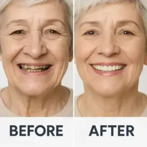 🦷 Denturelix™ Custom-Fit Functional Dentures 😁 Smile with Confidence