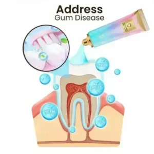 SmileFitPro™ Niacinamide Whitening Toothpaste