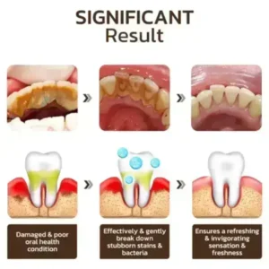 SmileFitPro™ Niacinamide Whitening Toothpaste